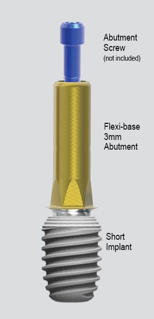 Web Diagram for CG.V Blue